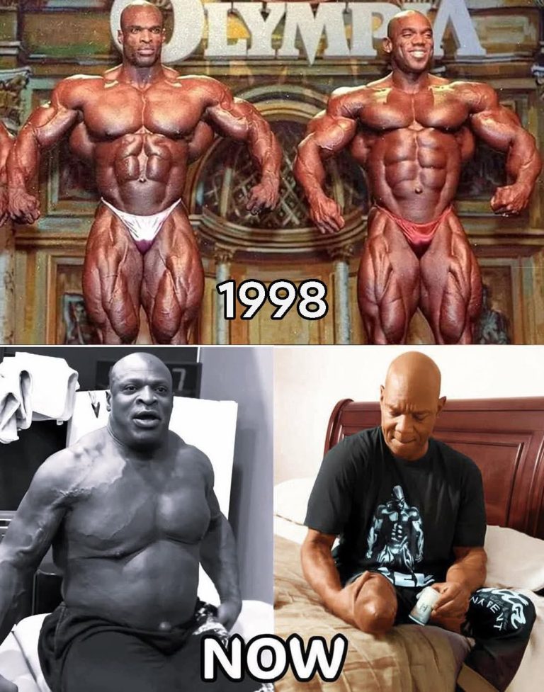 They Built Godlike Bodies — But the Price Was Painfully Human