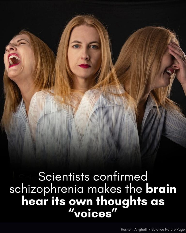 Scientists have confirmed that Schizophrenia’s “voices” are the brain mishearing its own thoughts
