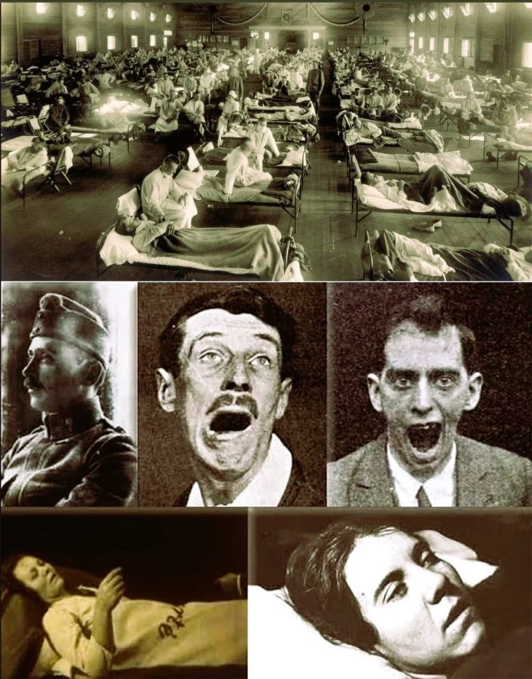 The Forgotten “Sleeping Epidemic” — The Plague That Froze the Living