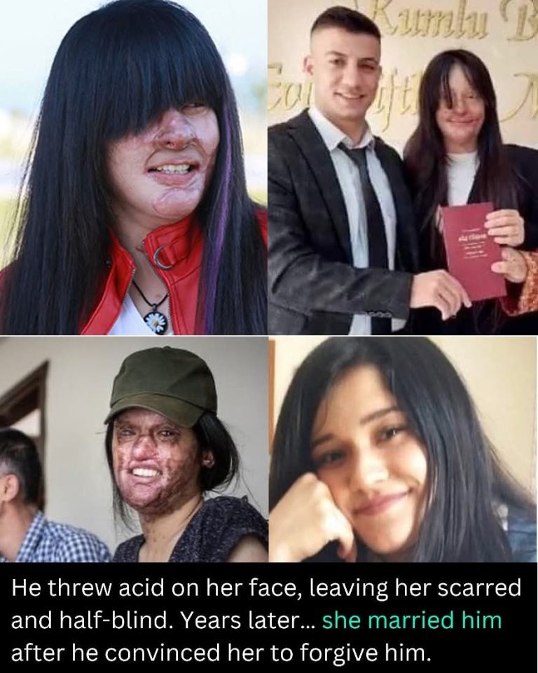 She married the man who threw acid on her face