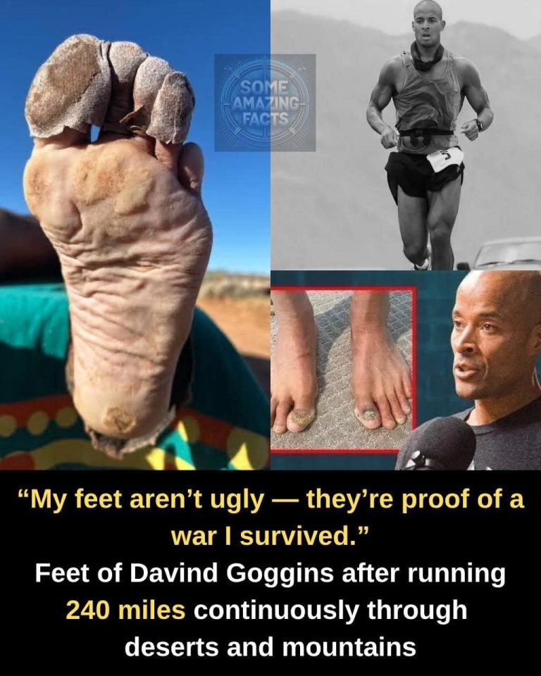 Every Scar Is A Receipt